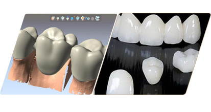 CAD/CAM方案設(shè)計(jì)